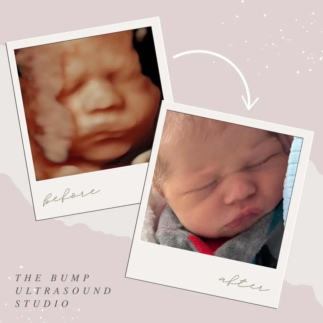 The Bump Ultrasound Studio