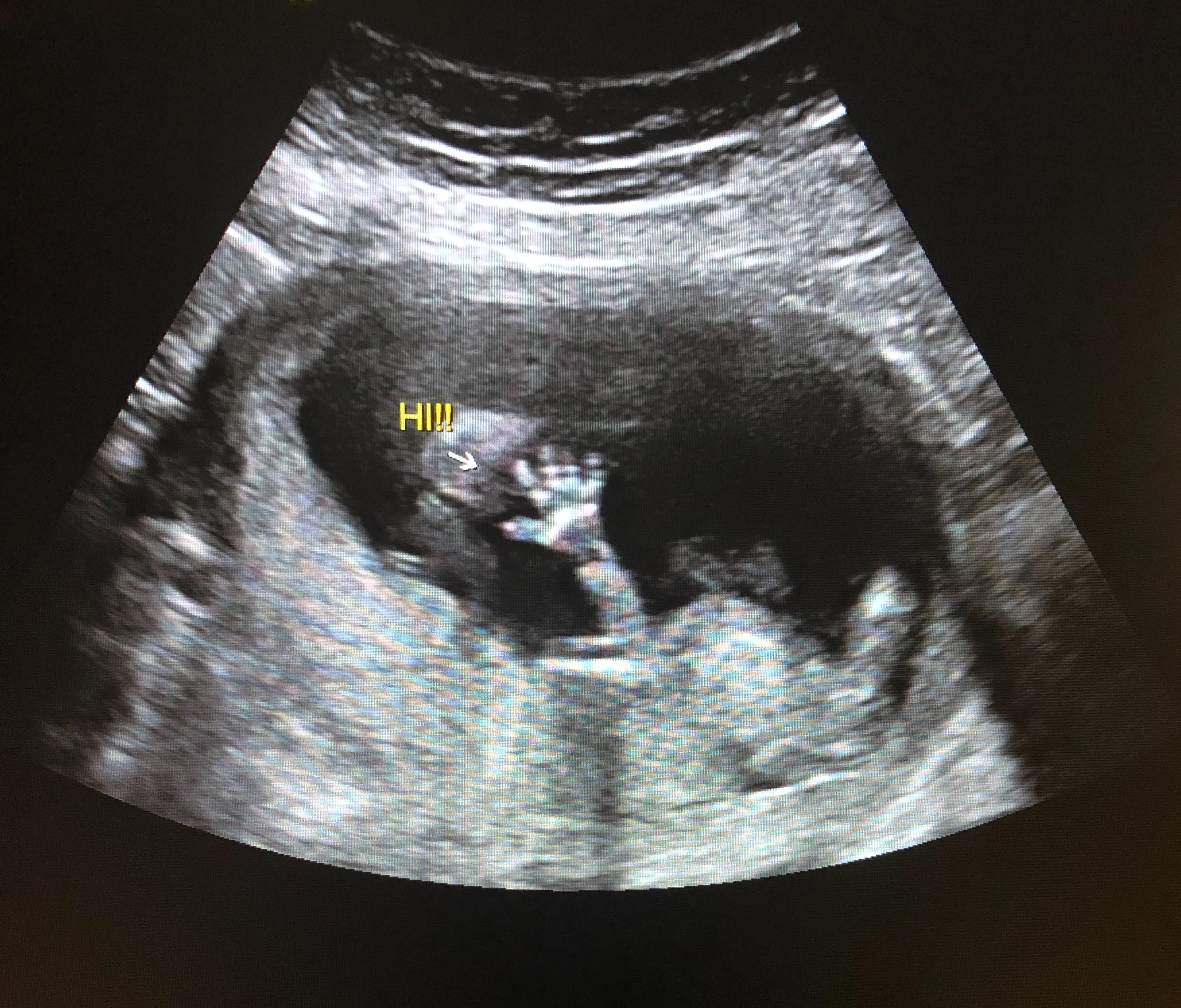 The Bump Ultrasound Studio